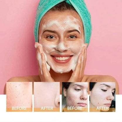 Veecent Turmeric + Kojic Acid Foaming Facial Cleanser