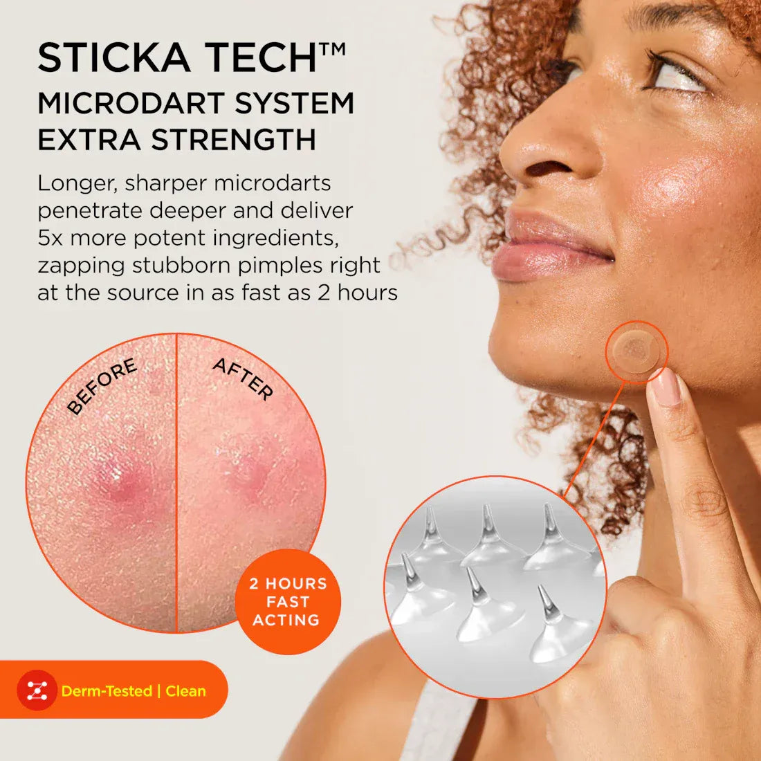 KILLA Microdart Pimple Patches