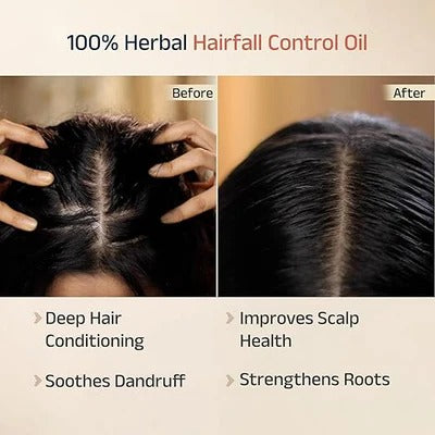 Vedix Keshamrut Herbs Infused Hair Oil