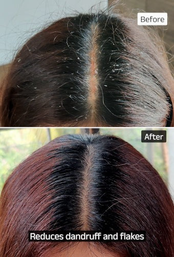 Vedix Keshamrut Herbs Infused Hair Oil